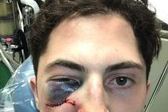 Video: Zranění Zacha Werenského