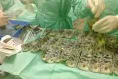 Žena po hádce s manželem snědla společné životní úspory