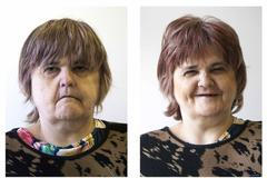 Gratias Tibi - Každý může být krásný - proměny mentálně postižených pacientů