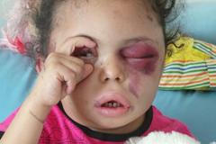 Holčička Buthaina Jemen