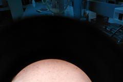 Ilustrační fotografie, veš muňka, muňky, holení, ochlupení, parazit, 2018