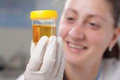 Moč - test - testování - vzorek