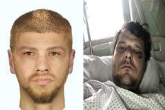 Pejskař napadl cyklistu - Letňany