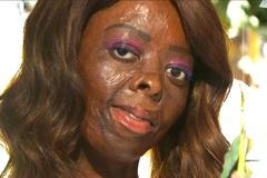 Zjizvené a plešaté modelky na Fashin Weeku. Kanadský návrhář mění hranice krásy v módním průmyslu