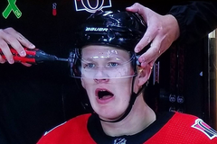 Příliš krutá daň za neproměněnou šanci. Sledujte Sportovní Sociál