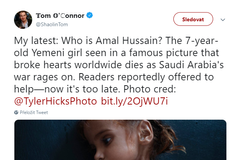 Hladovějící jemenská dívka Amal Hussejnová