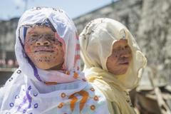 Albíni v Ghaně: Zabíjí je nenávist i rakovina kůže. Češi vymysleli, jak jim pomoci