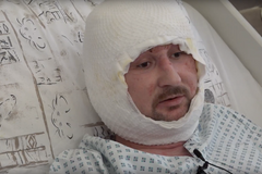 Těžce popálený horník z Karvinska má kritický stav za sebou. Teď už rehabilituje