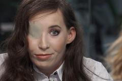 Narodila se bez tváře: Potřebuji dva miliony na poslední operaci, lékaři říkali, že se nedožiju roku