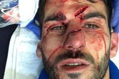 Aston Villa - Reading