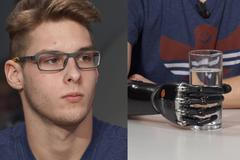 Dostal bionickou ruku za 750 tisíc: Už zavážu tkaničky, nikdy jsem se nechtěl vzdát