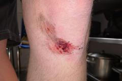 Zranění sociálního pracovníka centra Naděje.