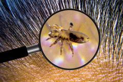 Veš dětská, vši, pedikulóza