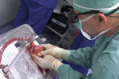 Transport bijícího srdce