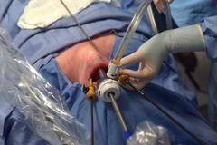 Operace štítné žlázy v Brně