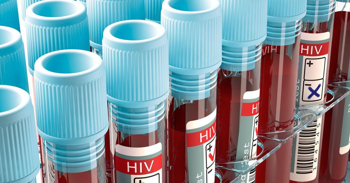 Nových případů HIV v Česku bylo loni 293, nejvíce v historii sledování