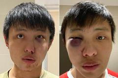 jonathan mok napadený koronavirus londýn