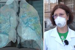 Život v pandemii - Martina Vašáková a plazma