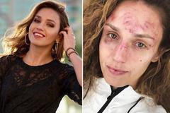 Prasklé kalhoty a zničená MMA kráska. Sledujte Sportovní Sociál