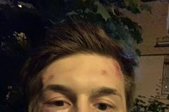 rusko opozice bloger zmlácený jegor žukov