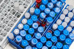 Koronavirus (covid-19) - ilustrační foto