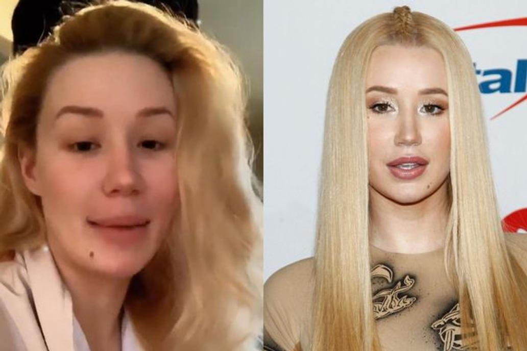 Iggy Azalea