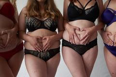 Tělo s příběhem: Ukazujeme vytahaná břicha, strie, jizvy jako součást mateřství. Po porodu je to šok