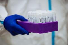 Tuzemsko / Ilustrační snímek / Rouška / Roušky / Pandemie / Epidemie / Covid-19 / Koronavirus / Lidé / Drive-In / Testování / Test / Odběr / 11. 10. 2020