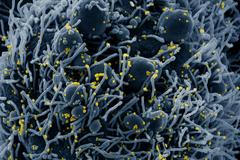 Fotografie koronaviru napadajícího buňky na snímcích z elektronkového mikroskopu, pořízené americkým Národním institutem pro alergie a infekční nemoci NIAID