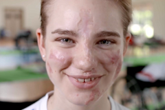 Fleretistka s handicapem