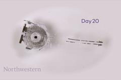 Přelomový vynález. Kardiostimulátor se pacientům rozpustí v těle