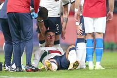 Obrazem: Ronaldo v Edenu cedil krev, ale o český debakl se postarali jiní