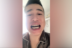 Otevřel ústa a vylekal se. Číňan s koronavirem se léčil s překvapivým symptomem