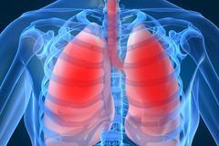 První příznaky - rakovina plic