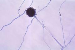 Houba Aspergillus
