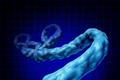 ebola virus