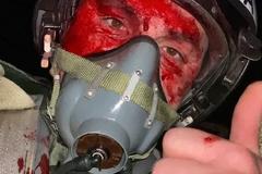 Zelenskyj ocenil padlého pilota F-16: Ovládal čtyři typy letadel, ztráta je bolestná