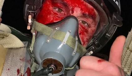 Zelenskyj ocenil padlého pilota F-16: Ovládal čtyři typy letadel, ztráta je bolestná