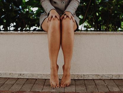 Prevence křečových žil