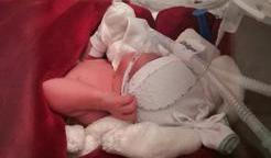 Lili, předčasně narozená dcera olympioničky Petry Chocové je bojovnice od narození.