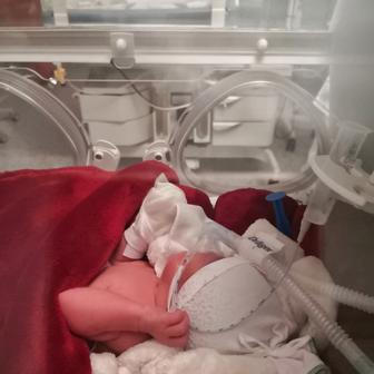 Lili, předčasně narozená dcera olympioničky Petry Chocové je bojovnice od narození.