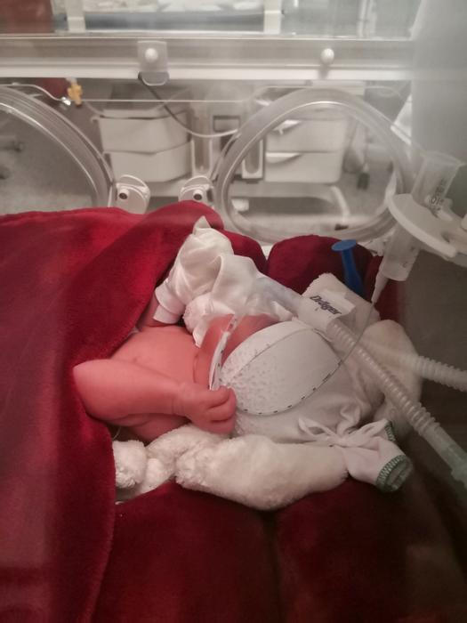 Lili, předčasně narozená dcera olympioničky Petry Chocové je bojovnice od narození.