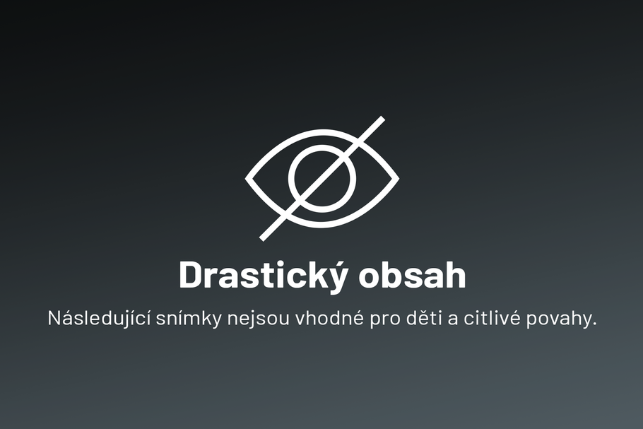 Upozornění na citlivý obsah