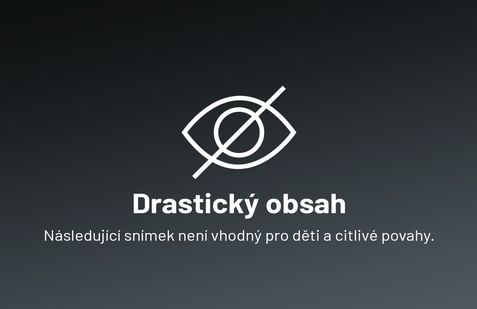 UPOZORNĚNÍ: Následující snímek není vhodný pro děti a citlivé povahy