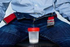 spermie, dárce, sperma