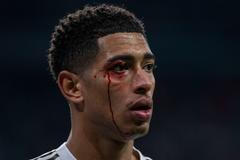 Zraněný Jude Bellingham v utkání Realu Madrid se Celtou Vigo