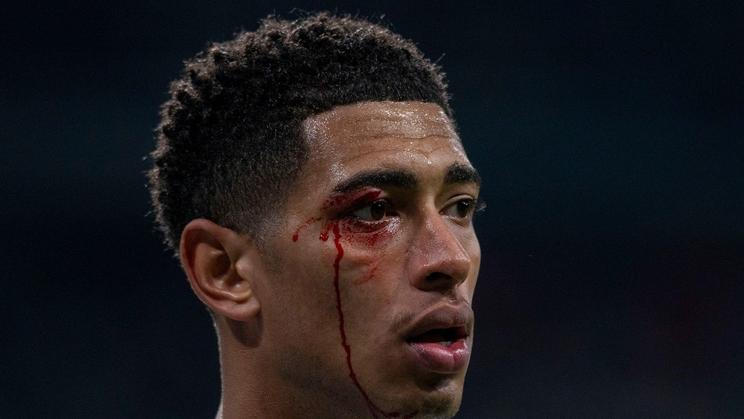 Zraněný Jude Bellingham v utkání Realu Madrid se Celtou Vigo