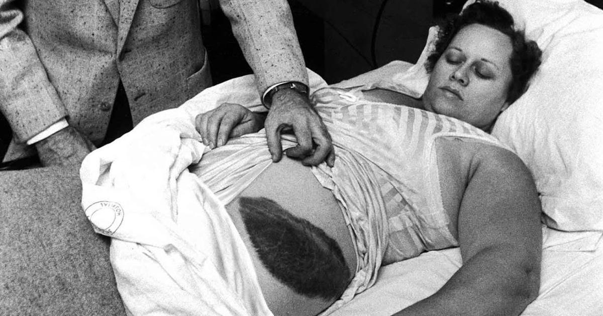 Dala si šlofíka na pohovce, vtom ji zasáhl meteorit. Po bizarním incidentu se o kámen soudila