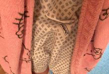 Inka se s ním potýká od raného dětství. „Pamatuju si situace, kdy se se mnou děti nechtěly kamarádit, protože to neznaly a nevypadalo to pro ně úplně pěkně,“ vzpomíná.