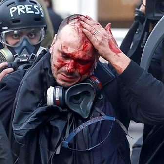 Tisíc traktorů vs. EU: Brutální střety u Evropského parlamentu